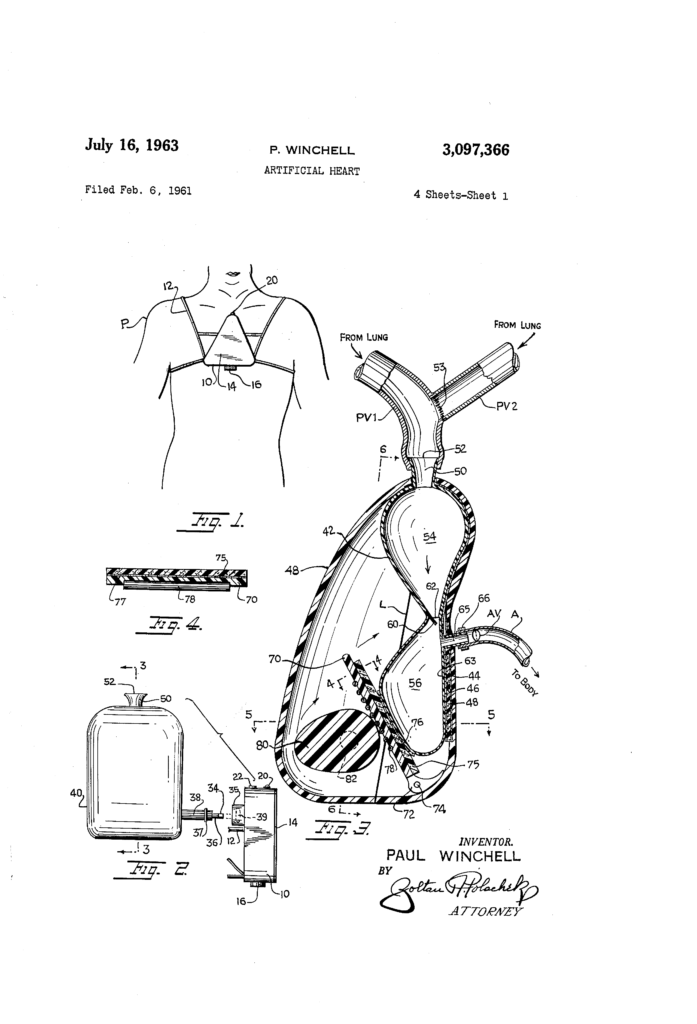 Today's Patent- ARTIFICIAL HEART - Lexprotector.com